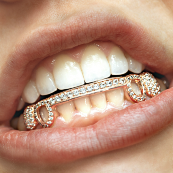 Grillz na zęby - nie tylko do teledysku